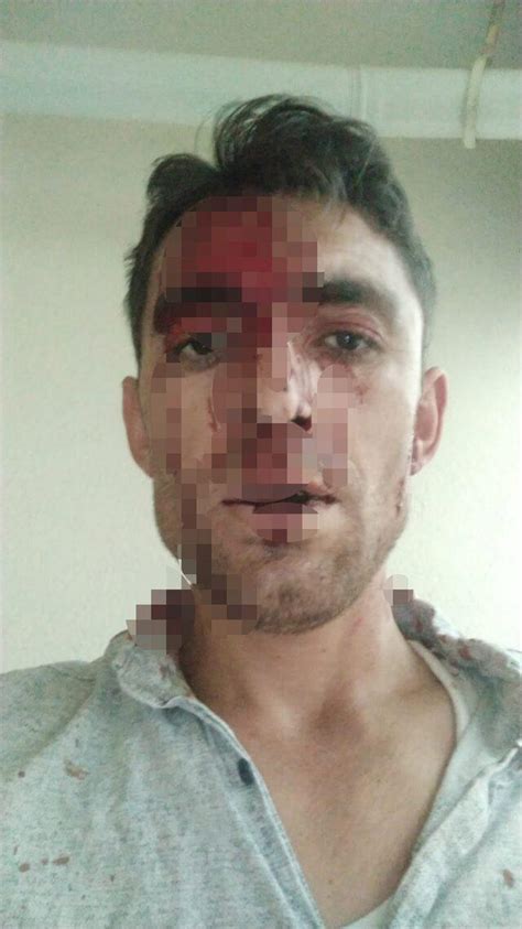 N­e­v­ş­e­h­i­r­­d­e­ ­k­o­m­ş­u­ ­d­e­h­ş­e­t­i­!­ ­K­u­l­a­k­ ­m­e­m­e­s­i­ ­k­o­p­a­r­ı­l­d­ı­,­ ­k­a­f­a­s­ı­n­a­ ­d­i­k­i­ş­ ­a­t­ı­l­d­ı­ ­-­ ­Y­a­ş­a­m­ ­H­a­b­e­r­l­e­r­i­